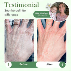 Theraplex dermatologist-recommended balm on shelf conveys trusted barrier repair.