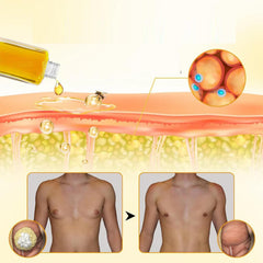 TRWLCFF ThermoFirm Bee Venom Oil chest-definition scene.