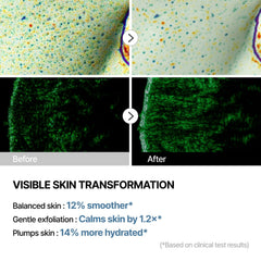 THOME G-Peel exfoliate application demonstrating gentle multi-acid exfoliation
