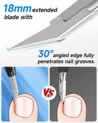 Tisojpod ingrown-nail-tip angled view demonstrates deep groove access for precise trimming