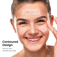 TKTK-contoured-patch-33x23mm on face hugs curves for precise coverage and quick absorption.