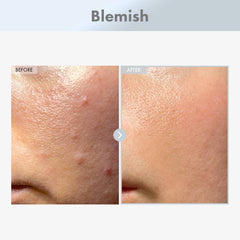 TOSOWOONG Niacinamide serum dispensing pump for easy daily use