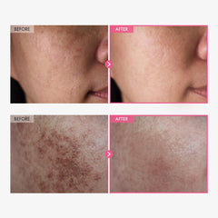 TOSOWOONG Arbutin 7% cream application on hand for daily use.