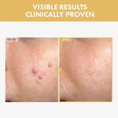 TOSOWOONG gel-serum texture close-up demonstrating fast absorption