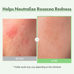 TOSOWOONG ingredient close-up with Centella and ceramide for soothing