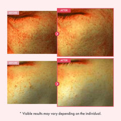 TOSOWOONG label close-up displaying niacinamide and arbutin strengths