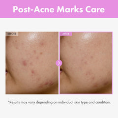 TOSOWOONG Niacinamide Hyaluronic Acid Serum on skin surface with hydration