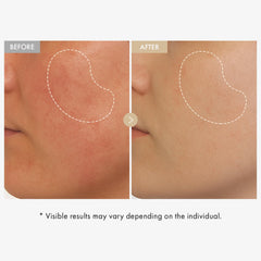 TOSOWOONG serum dropper dispensing texture, demonstrates fast absorbing hydration benefit