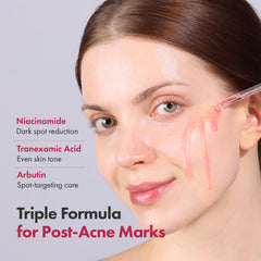 TOSOWOONG serum's lightweight watery texture delivers quick hydration.
