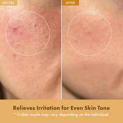 TOSOWOONG cream texture close-up demonstrating lightweight, non-greasy absorption