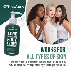TreeActiv Acne Eliminating Body Lotion texture close-up demonstrates smooth, hydrating daily feel.