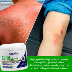 TriDerma Intense Fast Healing Cream AP4 Aloe Complex illustration highlights soothing skin support