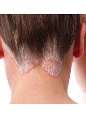 TriDerma psoriasis-control scalp exfoliator label highlights premium blend