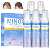 Trzsfr 5 percent minoxidil foam bottle close-up showing easy squeeze-foam application for hair regrowth