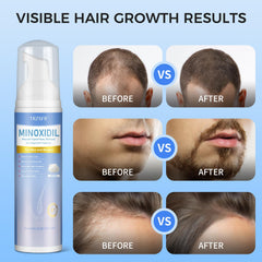 Trzsfr beard growth foam application for facial hair maintenance