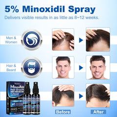 Tuymec Minoxidil beard-growth application illustrates multi-use capability