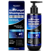 Tuymec psoriasis shampoo bottle for soothing scalp relief