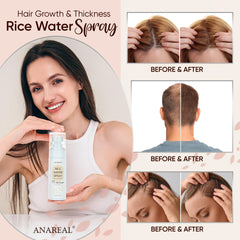 uikeaft Spray-on-scalp close-up supports nourishment and circulation.