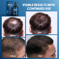 Ulluxe Biotin Hair Growth Shampoo sulfate-free label emphasizes gentle cleansing for sensitive skin