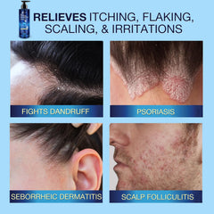Uttse anti-fungal shampoo label highlights active ingredients for gentle cleansing and scalp soothing.