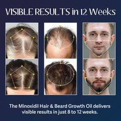 Venanoci beard growth oil dropper enables easy daily application for a fuller-looking beard.