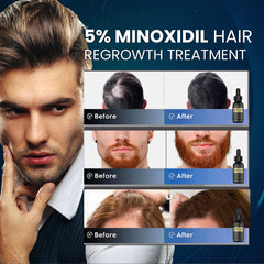 Venanoci Minoxidil dropper enables precise scalp application.