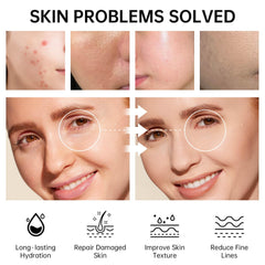 VGO hydrating toner image demonstrates moisture balance for smoother skin.