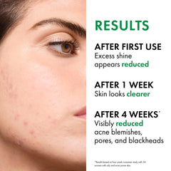 VICHY Normaderm foamy lather on skin for effective oil removal