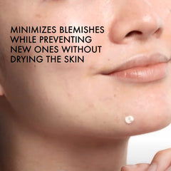 Vichy Normaderm tube and cap detail highlighting precision applicator benefit