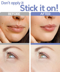 Vilvin dissolving microdart patches applied under-eye area for hydration and smoothing