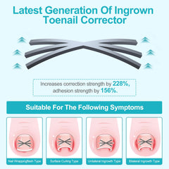 VITASY 6-angle corrector in-use shows adaptive correction for curved nails.