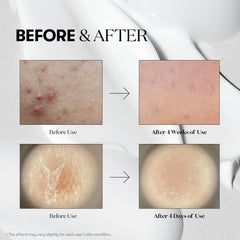 VT COSMETICS Reedle Shot 700 bottle suggests revitalized vitality for daily anti-aging care.