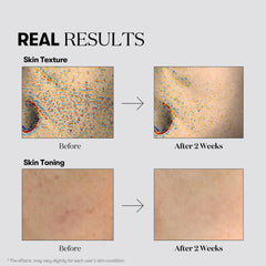 VT COSMETICS TX Toning Daily Mask closeup glow suggests brightened, even-toned skin potential