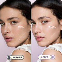 WLU Dermaplane Razor purple-sonic-movements demonstrates gentle exfoliation for refreshed, radiant skin