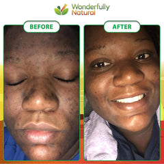 Wonderfully Natural African Black Soap shea butter detail emphasizing moisturizing nourishment from natural oils.