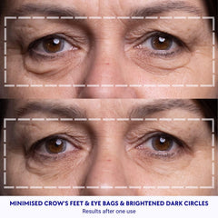 Wrinkles Schminkles patches after use showing easy removal and storage