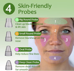 Xamoca blackhead remover vacuum display highlights battery and suction level for easy monitoring.