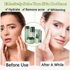 Xiuxixu Avocado Eye Cream tube to reduce dullness and fine lines.