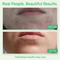 YEOUTH Glycolic Acid Peel retinol bottle signals skin renewal in routine.