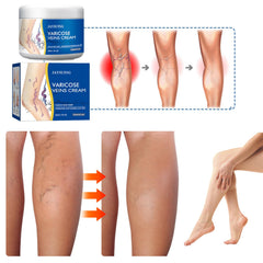 Yetary crema para piernas, hidratación profunda y piel suave