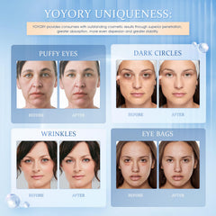 YOYORY eye patches packaging in blue, premium skincare convenience.
