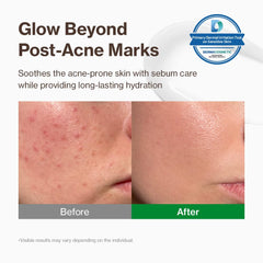 YUMU Cica Exosome Zinc Blemish Relief Cream texture swatch showing lightweight gel-cream feel