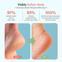 ZenToes night-time pedicure ritual scene promotes relaxing heel care routine.