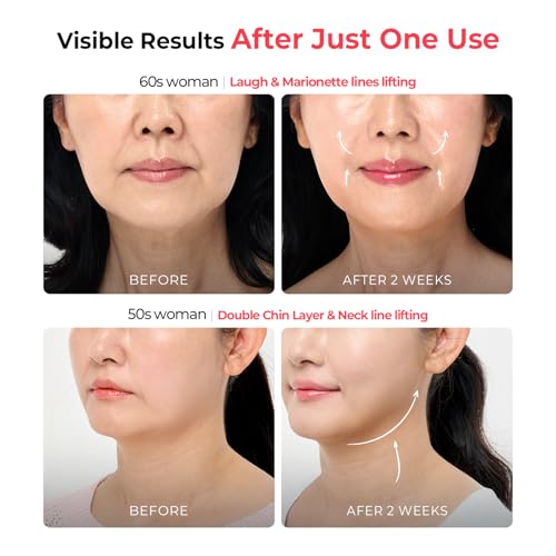 Aalok Ultra Olla 10-minute routine image highlights quick salon-inspired lifting at home