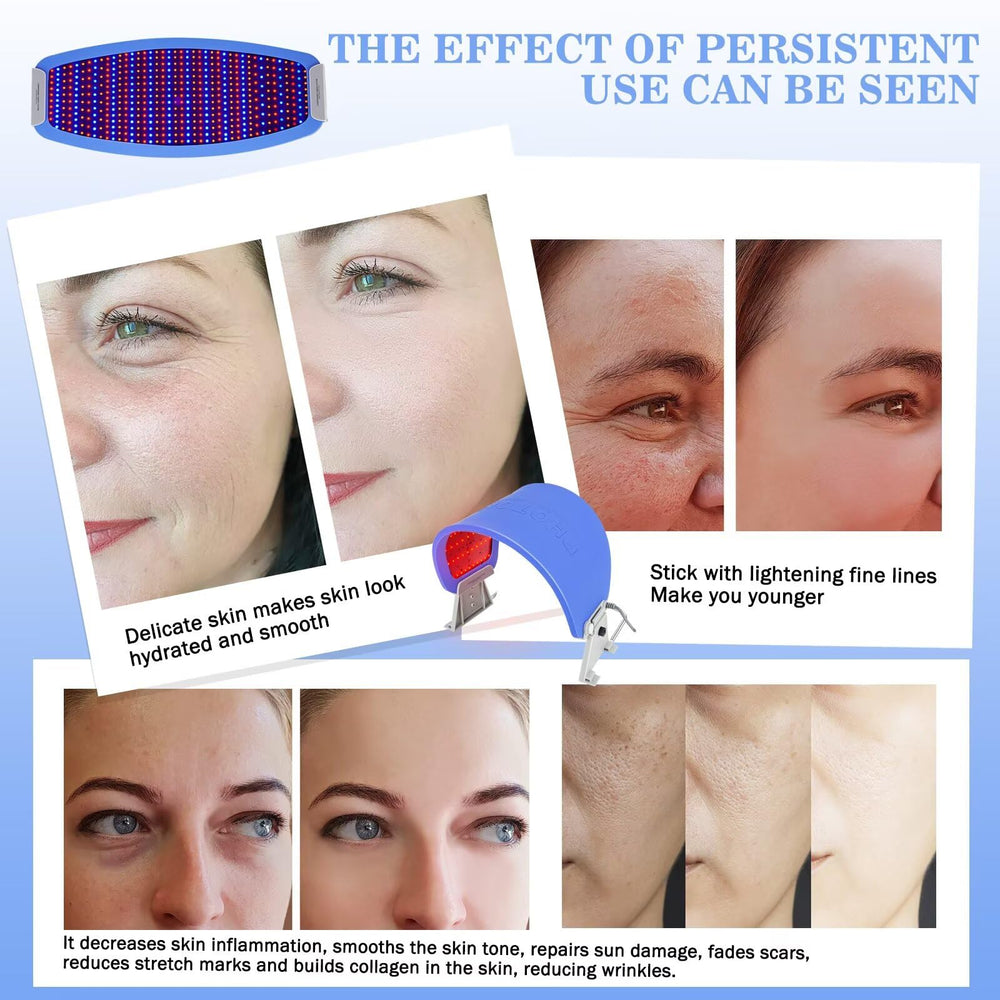 AAOCARE close-up of light therapy on the face in action