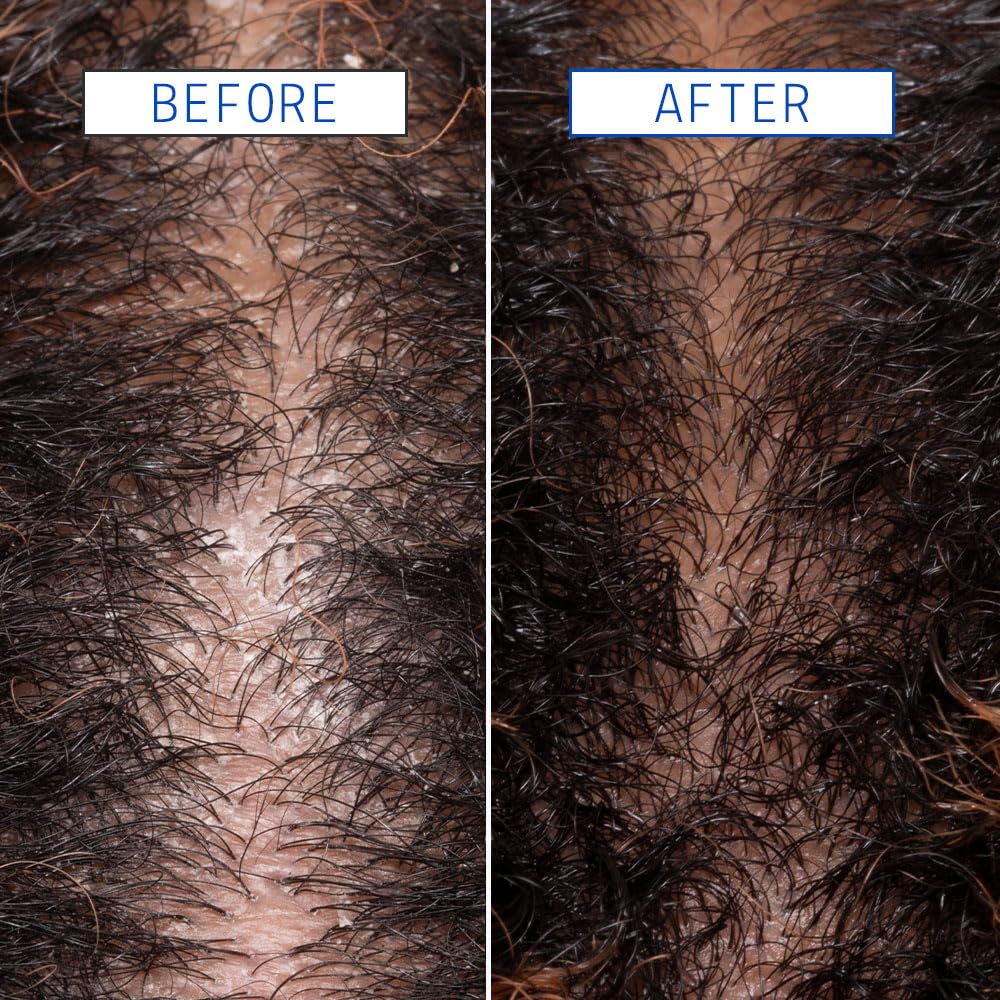 AAVRANI Scalp Detox Jelly Cleanser built-in scalp scrubber for deeper exfoliation during wash