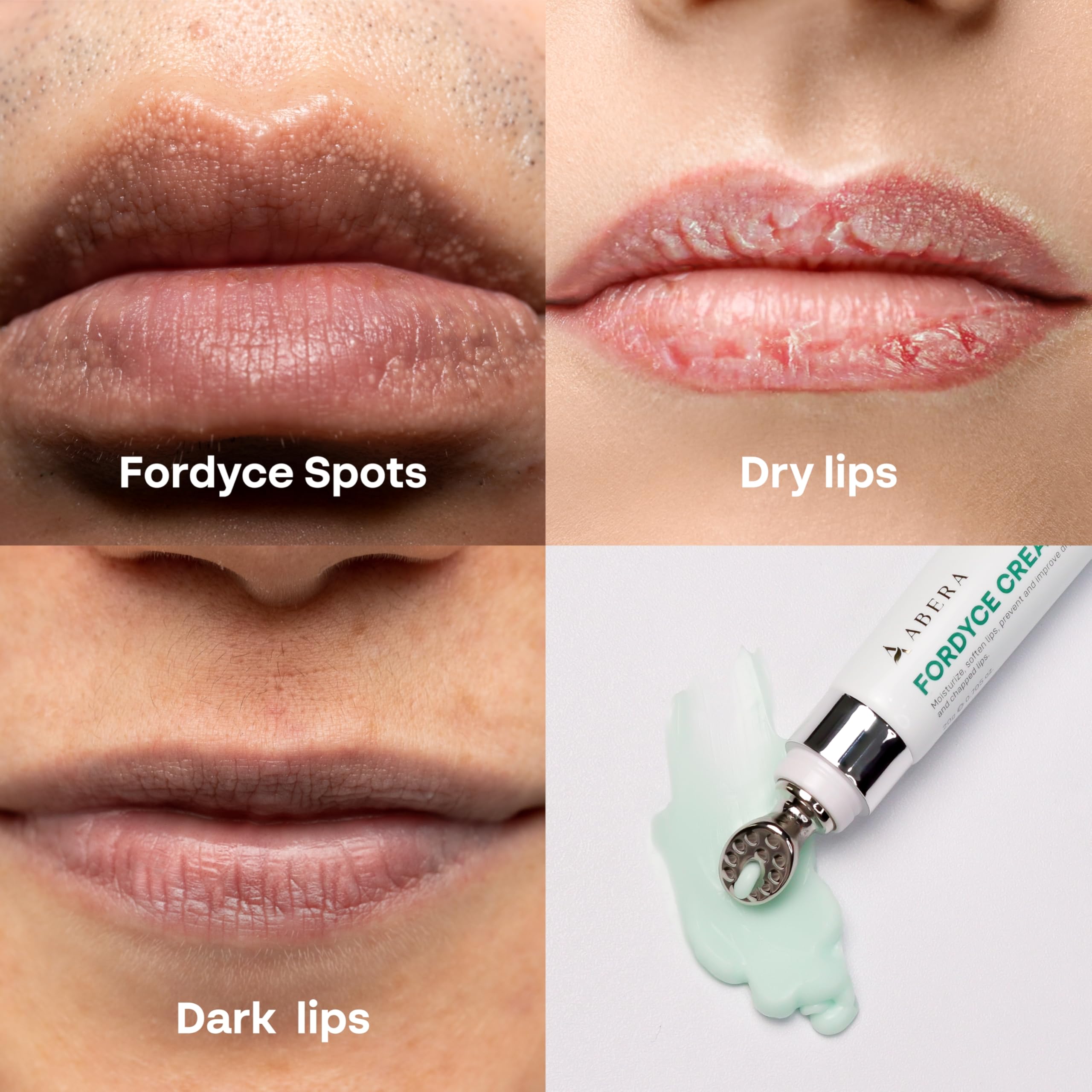 Abera Fordyce Cream illustrates barrier support with ceramide and vitamin E.