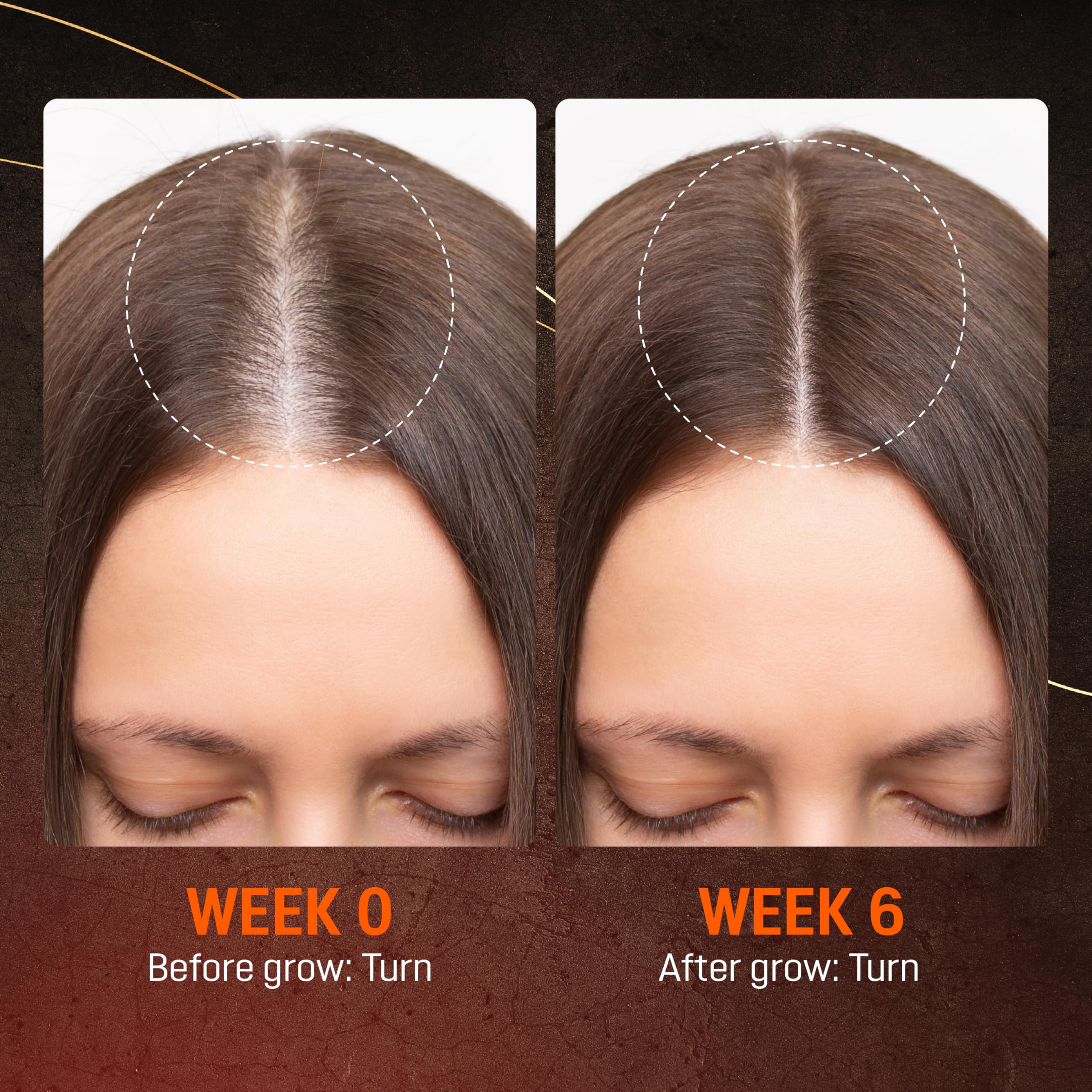 ABERA hair growth serum packaging designed for easy daily use