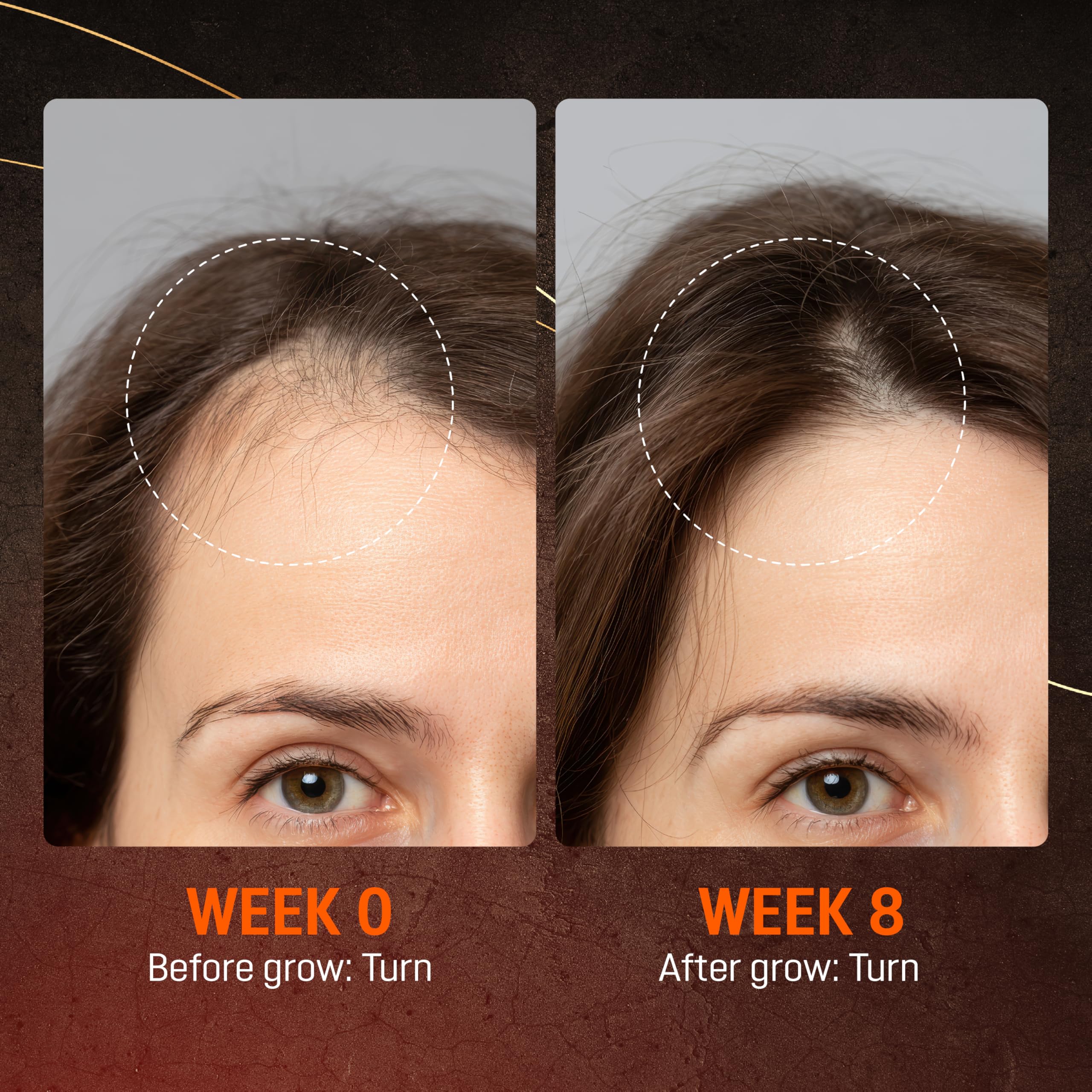 ABERA hair growth serum nourishing scalp for healthier-looking hair