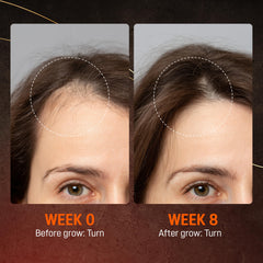 ABERA hair growth serum nourishing scalp for healthier-looking hair